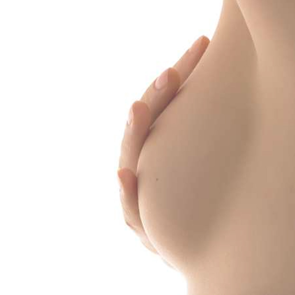 Chirurgie esthétique des seins